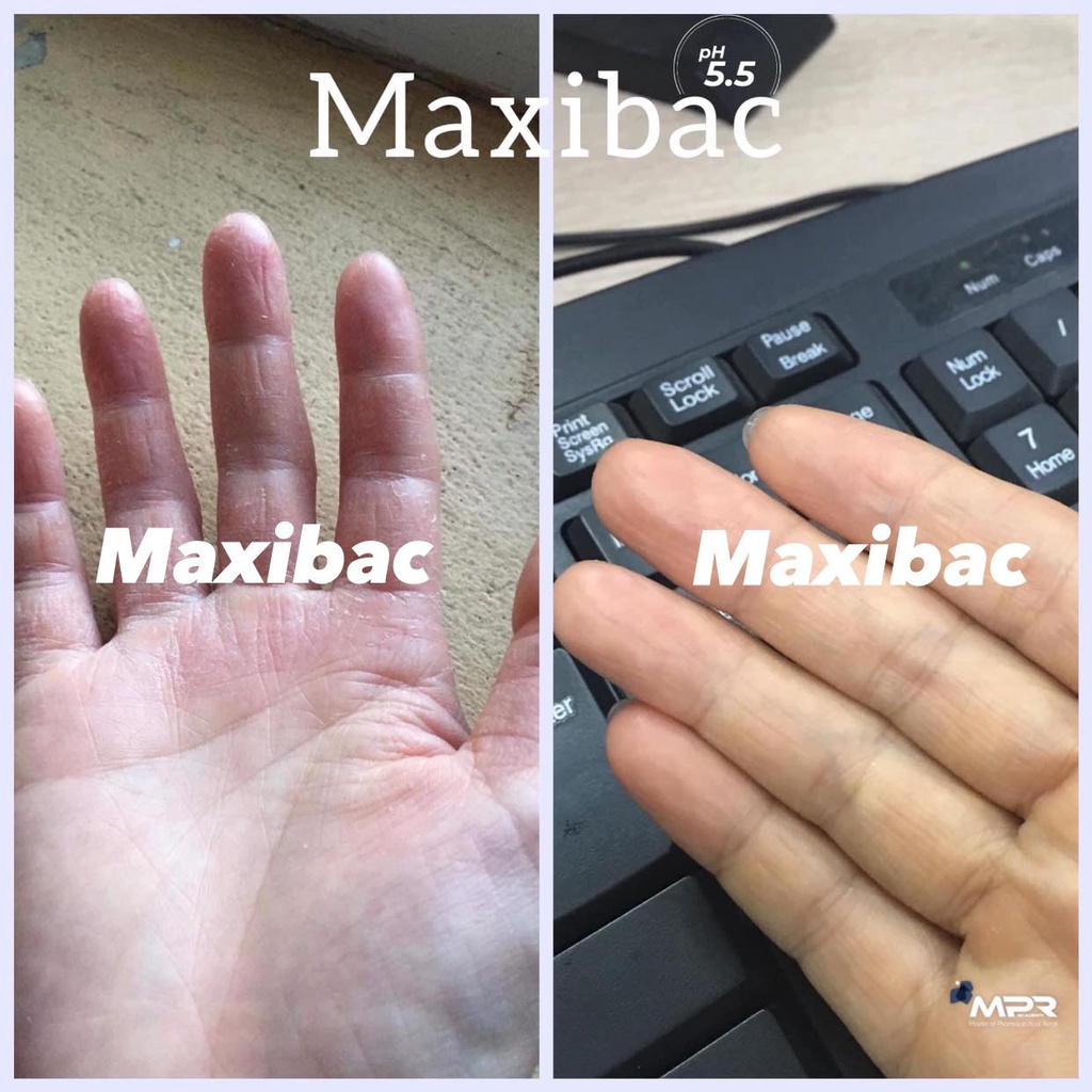 Kem dưỡng ẩm tay chân Khô Ráp Bong Tróc Nứt Nẻ, Nứt Gót Chân Chuyên Sâu Maxibac PH5.5 Không Nhờn Rít Không Dính Bết