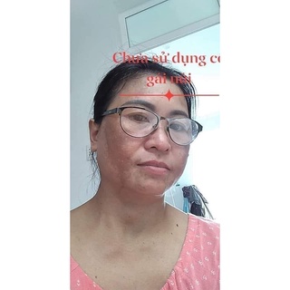 Cỏ trừ nám Cô Gái Núi