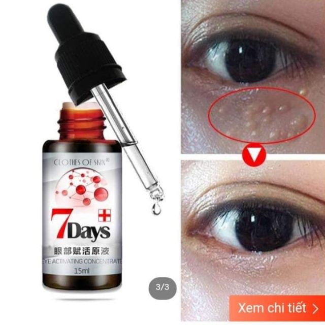 Tinh Chất  Mụn Thịt Quanh Mắt