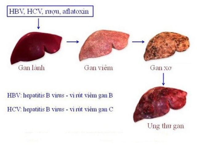 Hộp 50g trà cà gai leo túi lọc(mụn mẫn ngứa keto, gan)