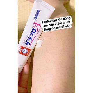 Kem trị viêm lỗ chân lông Rohto Nhật Bản