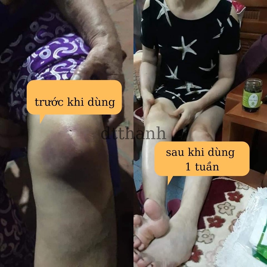 Dầu nga xoa bóp loại 100gr cho người b..ị xương khớp