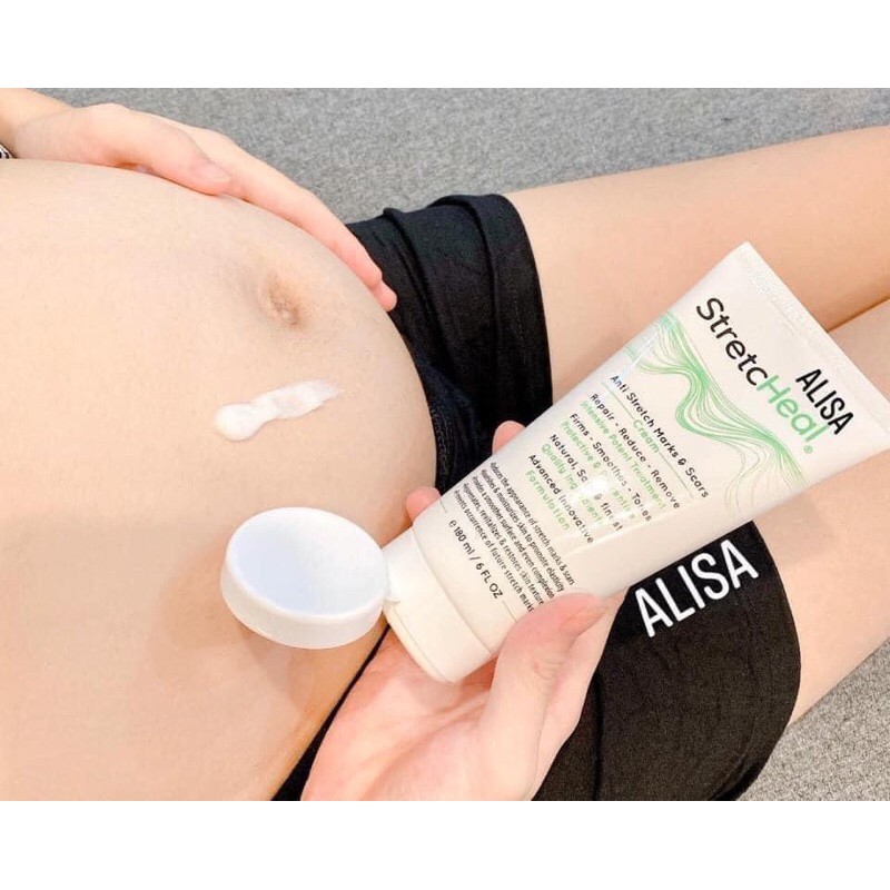 Kem mờ vết rạn số 1 StretcHeal | BigBuy360 - bigbuy360.vn