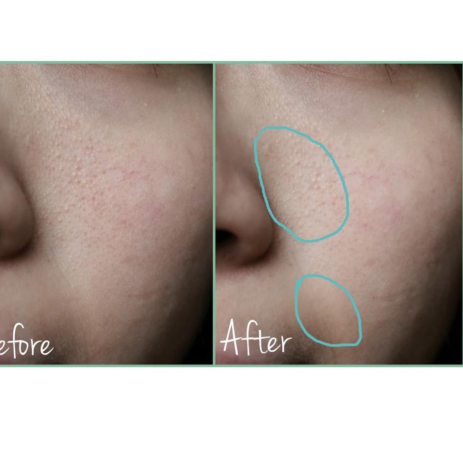 Gôm Tẩy Làm Sạch Lỗ Chân Lông Tức Thì Maybelline