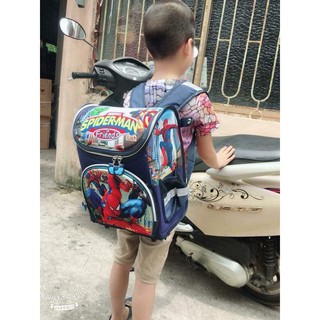 Balo chống gù cho bé