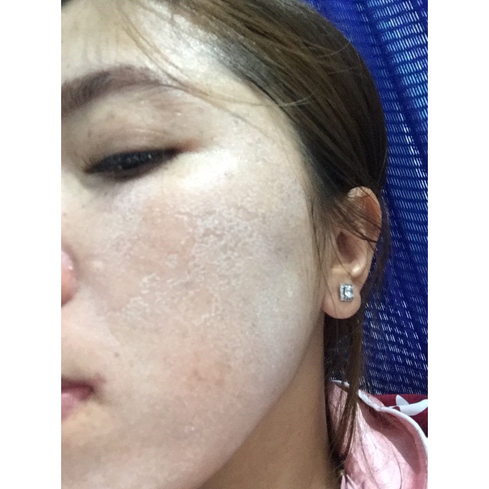 KEM TÁI TẠO TÁI SINH DA ĐÔNG Y l Loại Rỗ Bongmanh | BigBuy360 - bigbuy360.vn