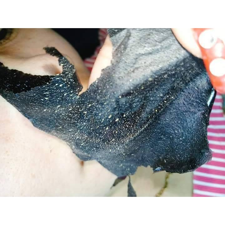 [Chính Hãng] GEL LỘT MỤN THAN TRE NGÂN BÌNH - Siêu Sạch Lột Sạch Mụn Cám, Mụn Đầu Đen, Se Lỗ Chân Lông | BigBuy360 - bigbuy360.vn