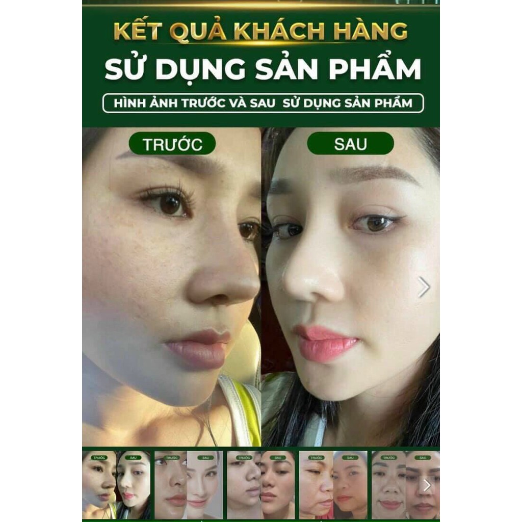 Siêu vi tảo Green Vita -  tái sinh da siêu vi tảo Nhật (TẶNG KÈM GHIM CÀI ÁO CỰC YÊU) | BigBuy360 - bigbuy360.vn