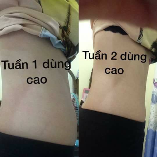 Giảm Giá Sốc Tan Mỡ Bụng Cao Lá Rừng