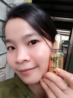 Tavida da xấu thành đẹp