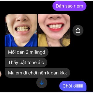 Miếng dán răng mẫu mới 2024 - dành cho mọi loại răng.