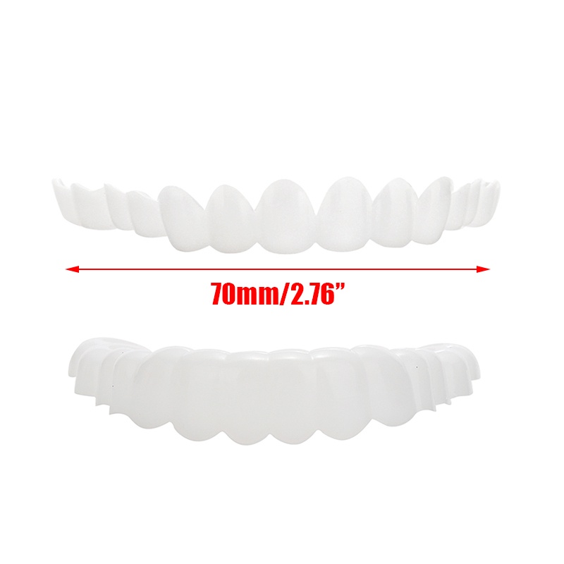 Nha khoa chụp trên nụ cười hoàn hảo tức thì veneers răng thoải mái trên & dưới