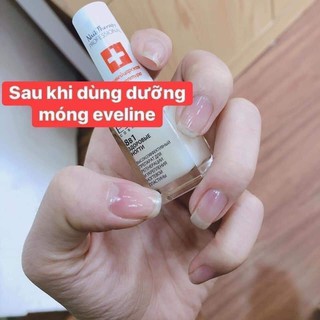 Dưỡng móng Eveline 8in1 [ Chính hãng ]