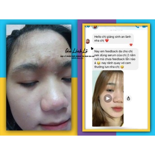Serum Gia An