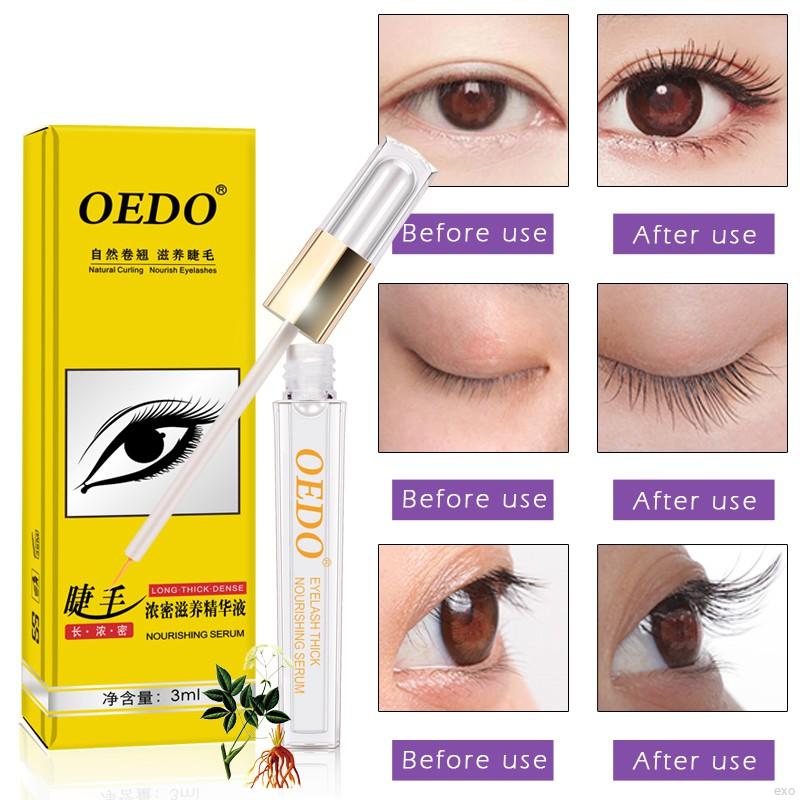 [Hàng mới về] Serum Kích Thích Mọc Lông Mi Thương hiệu OEDO