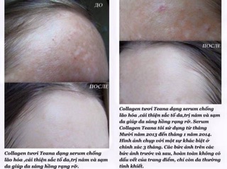 Serum Collagen tươi Tenana