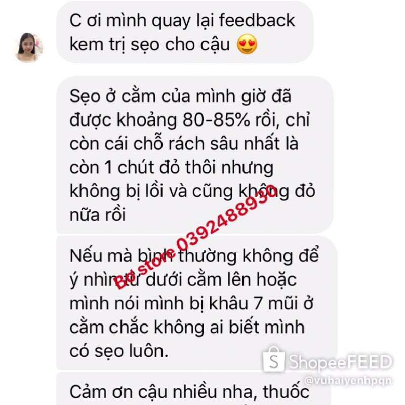 [NỘI ĐỊA ĐỨC] Kem làm mờ sẹo Contractubex tuýp 30g đủ bill(date mới nhất)