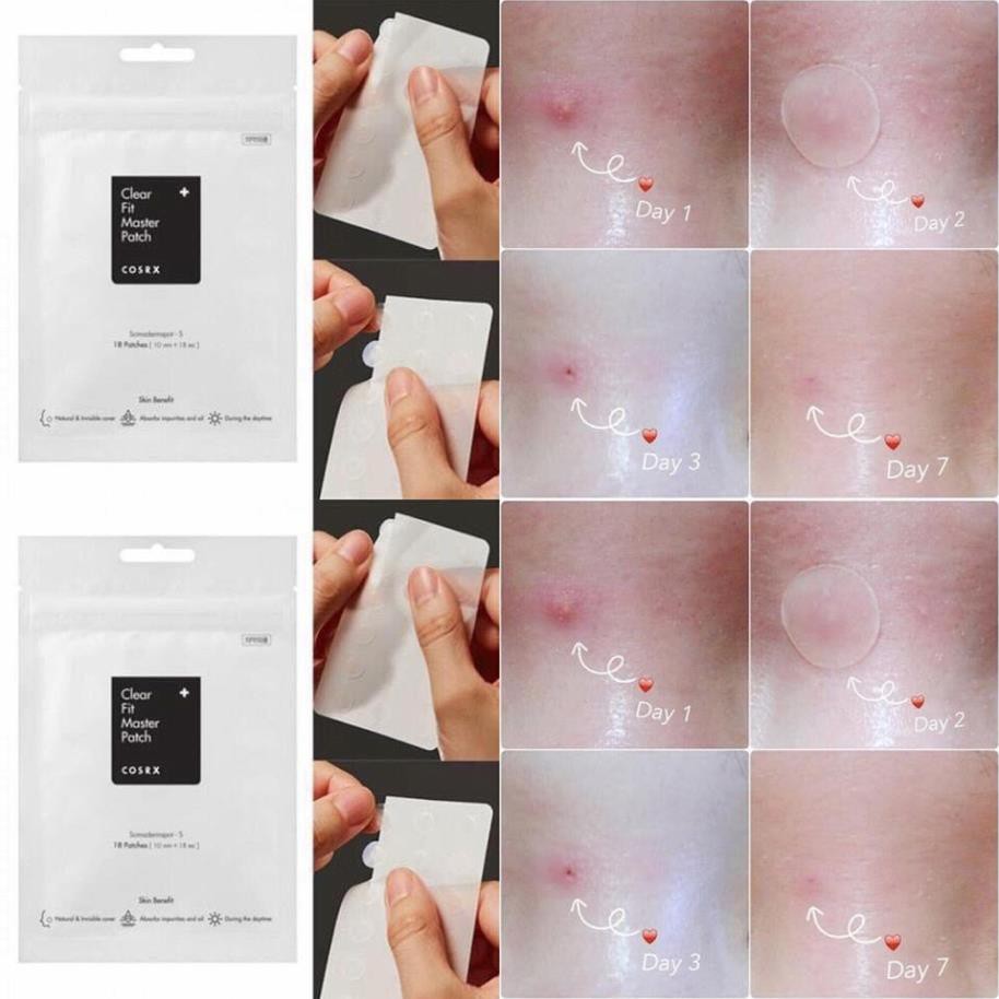 Miếng Dán Mụn Cấp Tốc Cosrx Acne Pimple Master Patch