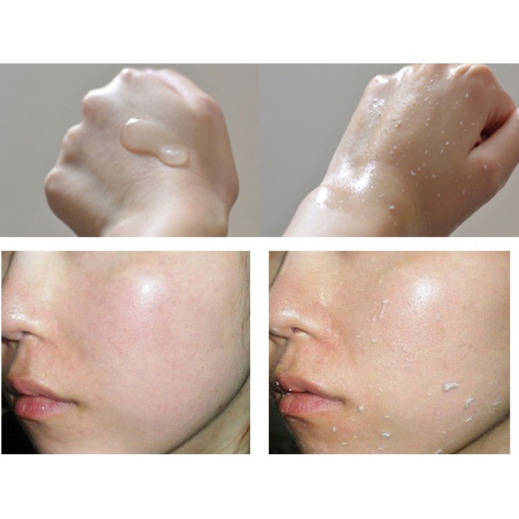 Kem Tẩy Da Chết, Tế Bào Chết Cho Mặt Và Toàn Thân Benew Charcoal Detox Peeling Gel  Hàn quốc 120ml/Hộp