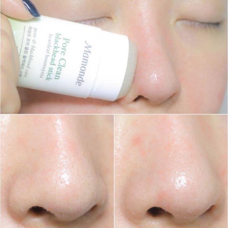 Thanh Lăn Mụn Đầu Đen Mamonde Diếp Cá