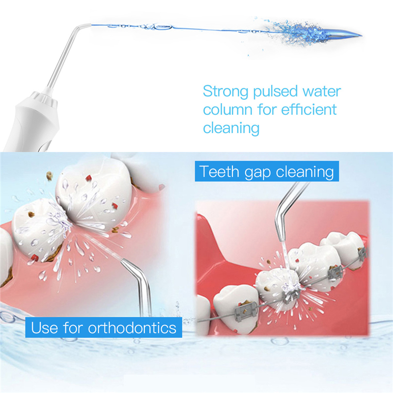 Máy tăm nước CKEYIN chăm sóc răng miệng sạc lại được tiện lợi