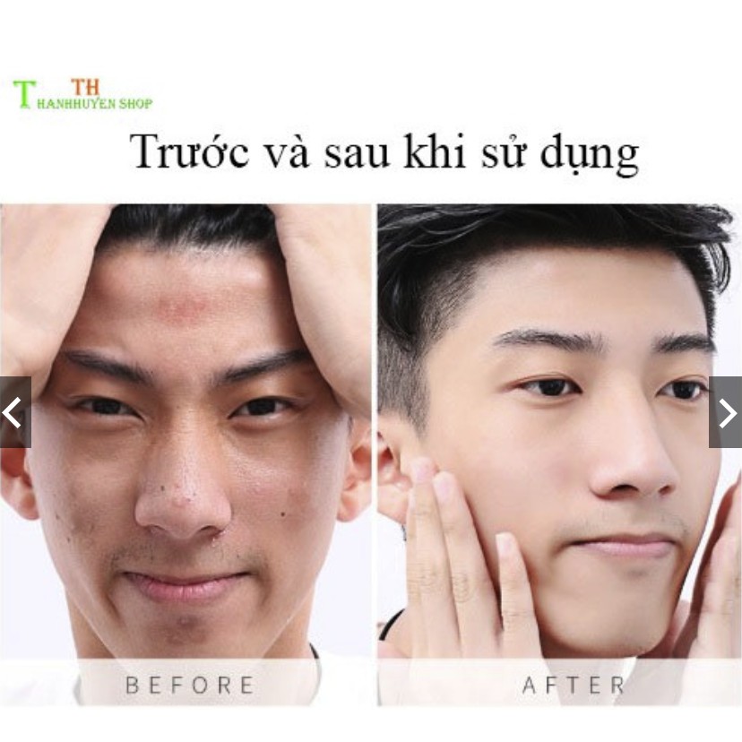 Sữa Rửa Mặt Men's Cleanser Cho Nam Làm Sáng Da Ngăn Ngừa Mụn Kiềm Dầu Loại Chất Nhờn Cấp Ẩm 4in1