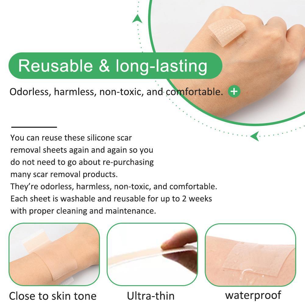 Set 4 miếng dán loại bỏ sẹo ALIVER y tế silicone gel phục hồi làn da M4N1
