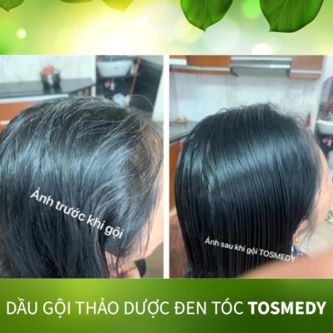[HÀNG ĐỘC QUYỀN] Dầu gội thảo dược đen tóc TOSMEDY - Công ty CP Dược TW Mediplantex - Đen tóc chỉ sau 01 lần gội. | Thế Giới Skin Care
