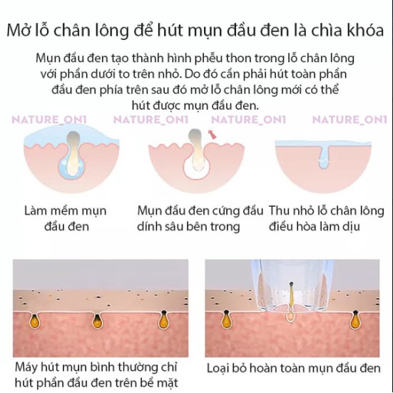 Máy Hút Mụn ❤FREESHIP ❤ Lực Hút Mạnh - Nhỏ Gọn Tiện Lợi Khi Sử dụng - Phù Hợp Với Nhiều Loại Da an Toàn Cho Da