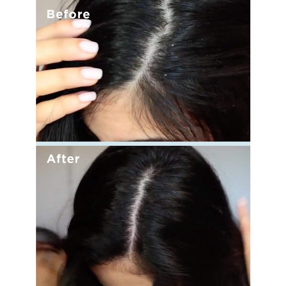 Sample Dầu Gội Tẩy Tế Bào Chết Briogeo Scalp Revival Shampoo 18ML