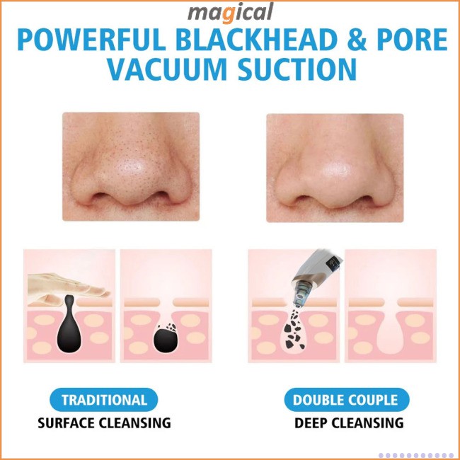 Electric Pore Cleansing Vacuum Blackhead USB Aspirator