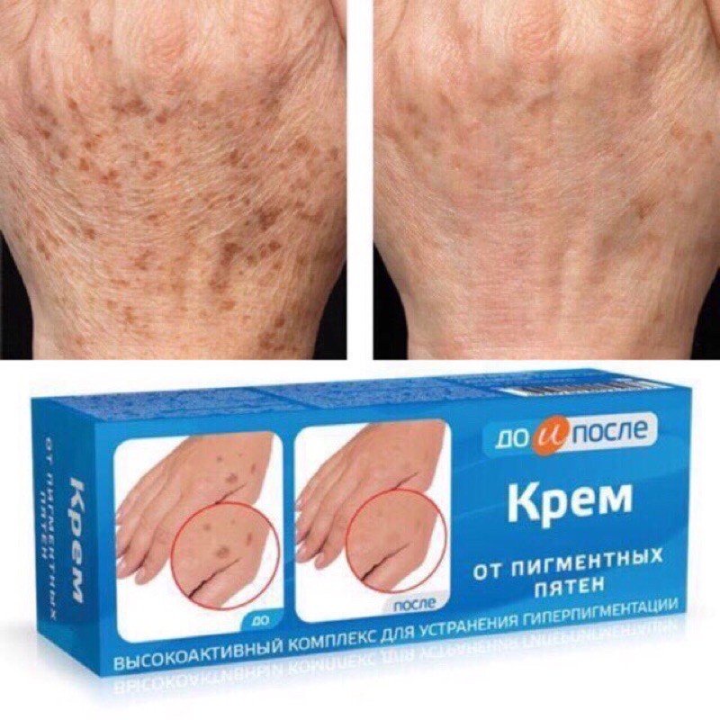 Kem Dưỡng Làm Mờ Phục Hồi Đốm Nâu Đồi Mồi Kpem Cream 50g