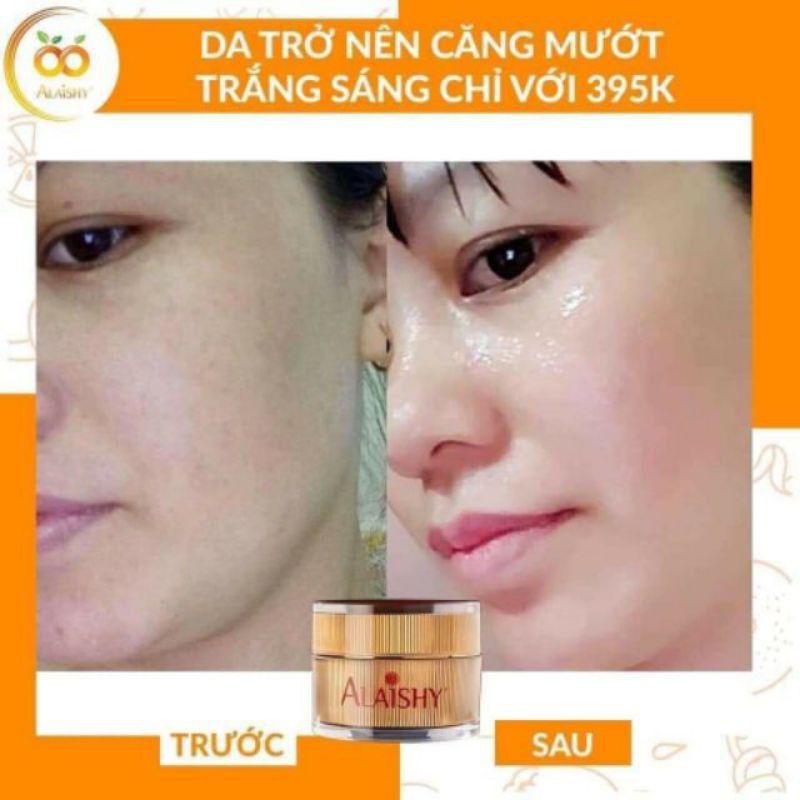 Kem face đêm Vitamin C Alaishy phiên bản nâng cấp mới