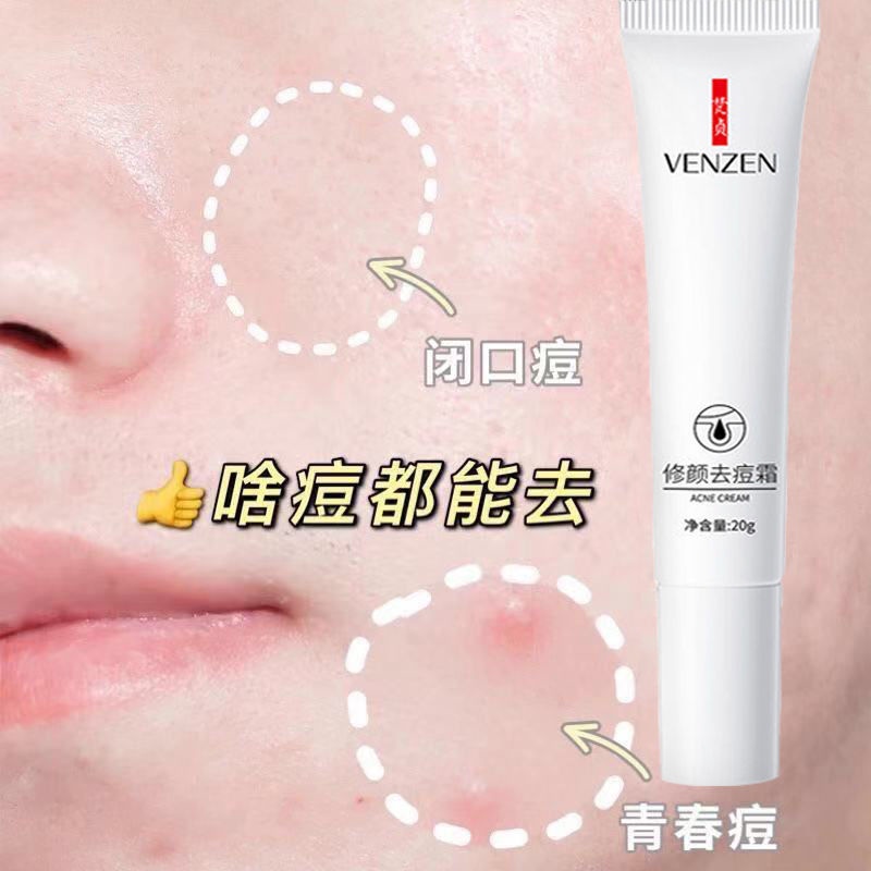 Kem Hỗ Trợ Giảm Mụn Trứng Cá Làm Mờ Vết Thâm Mụn Phục Hồi Miệng Trẻ Hóa Làn Da Cho Học Sinh Manshanzc.My11.27 | BigBuy360 - bigbuy360.vn