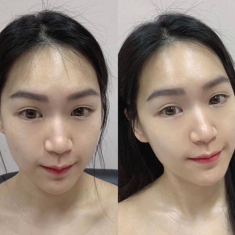 SALE Serum cấp ẩm HA Densimatrix ,sáng da Tran3x fullsize 30ml & phục hồi cân bằng da Mesoestetic