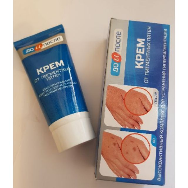 Kem loại bỏ đồi môi kpem nga_kem loại bỏ đồi môi tay chân