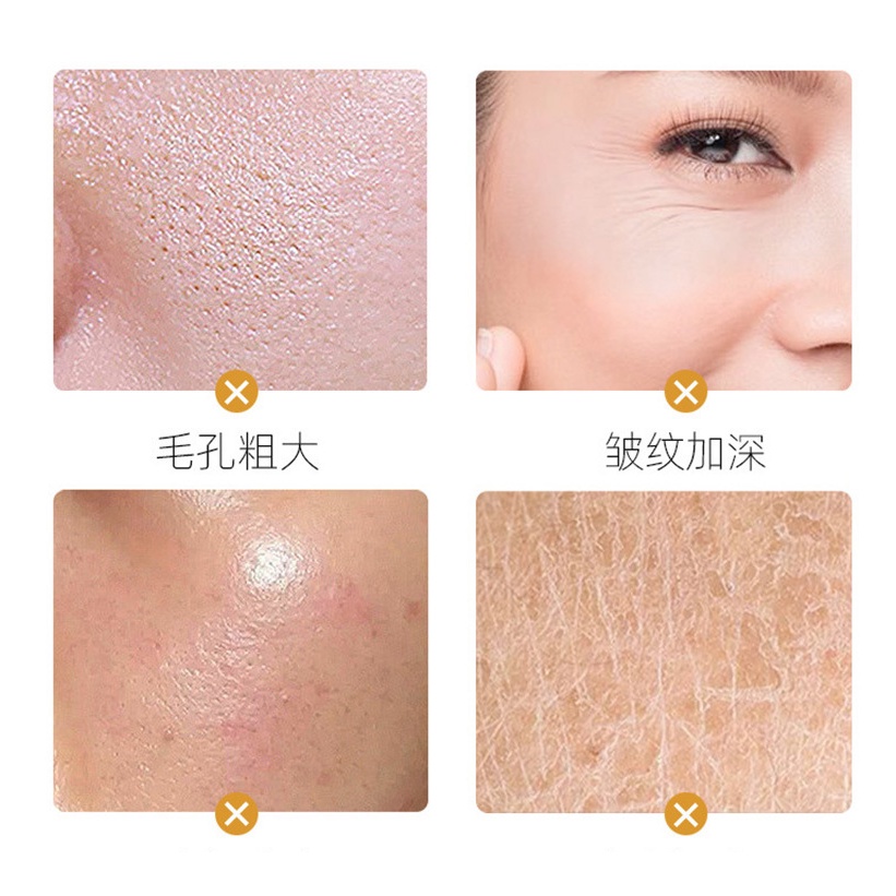 1 Viên Nang Chiết Xuất Nhau Thai Cừu Chiết Xuất Nhau Thai Cừu Chống Nếp Nhăn Làm Săn Chắc Da M0 A1