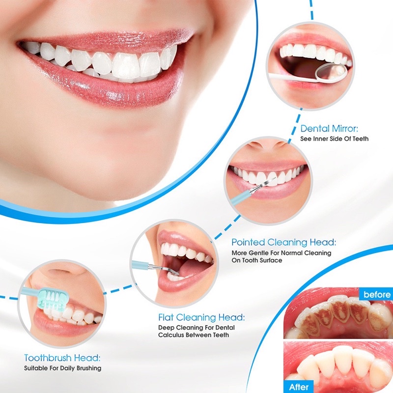 TẶNG 2 ĐẦU CHẢI, Máy lấy cao răng tại nhà,máy 2 in 1 lấy vôi răng kèm đánh răng sạc đế không dây.