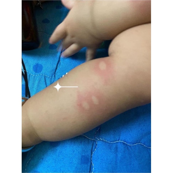 Lăn muỗi Muhi nhật