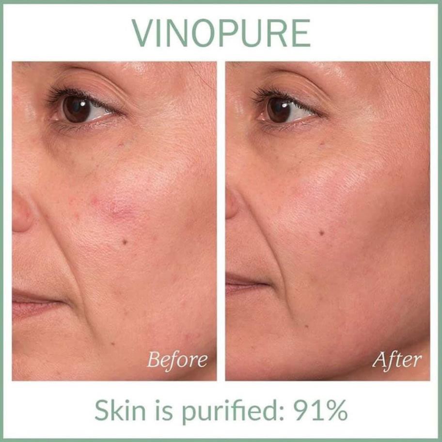 Serum Caudalie Vinopure Skin Perfecting Serum giảm dầu, thu nhỏ lỗ chân lông 10ml Mini