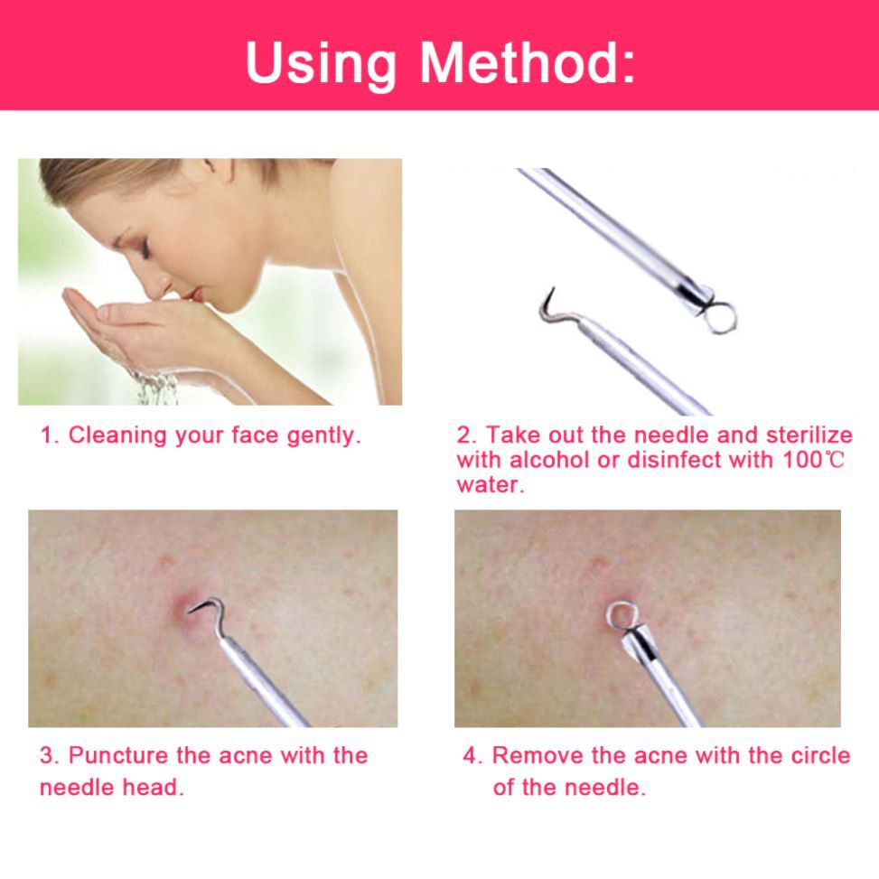 Set of 4 stainless steel blackhead removal tools for facial skin care