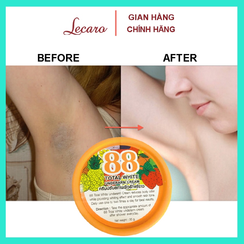 Kem giảm thâm nách, giảm thâm bikini total white 88 thái lan 35g LECARO