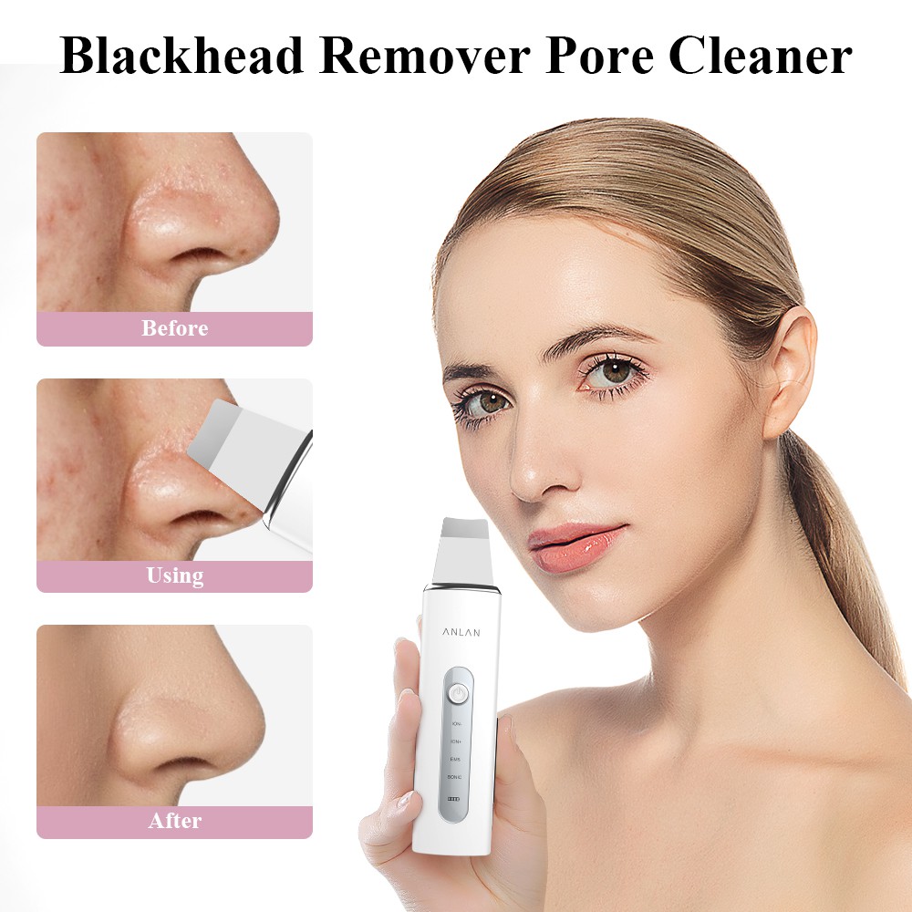 [Mã FMCGMALL - 8% đơn 250K] Máy Làm Sạch Da Anlan Sử Dụng Sóng Âm Có Thể Sạc Lại Giúp Loại Bỏ Mụn Đầu Đen | BigBuy360 - bigbuy360.vn