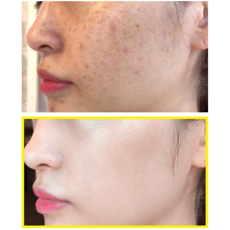 Some By Mi / Tinh Chất Dưỡng Trắng Da Some By Me Yuja Niacin 30 Days Blemish Care Serum