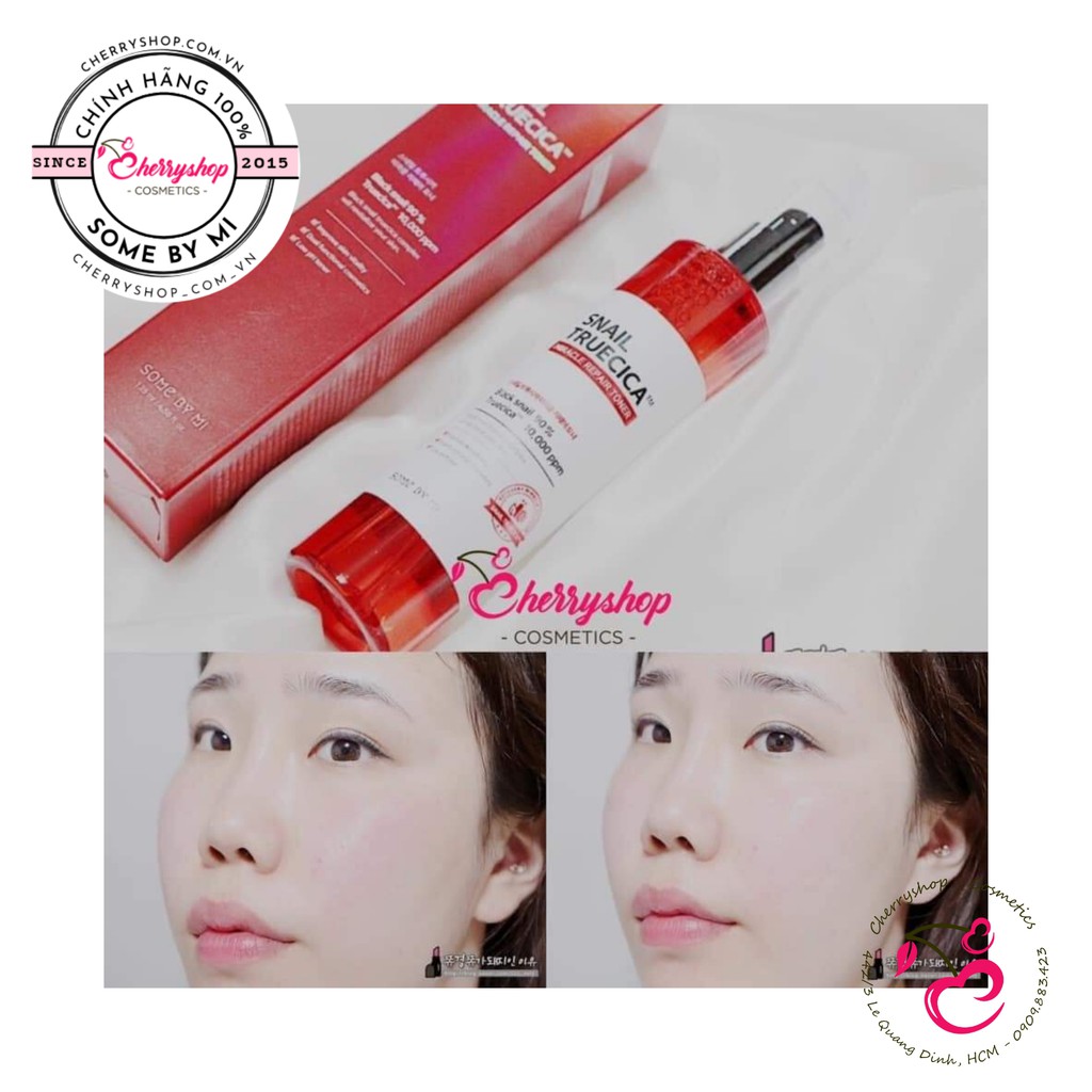 Nước hoa hồng Some By Mi Snail Truecica Miracle Repair Toner