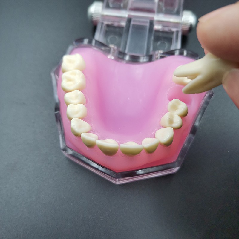 Mô hình hàm răng giả mềm có thể tháo rời tiện lợi