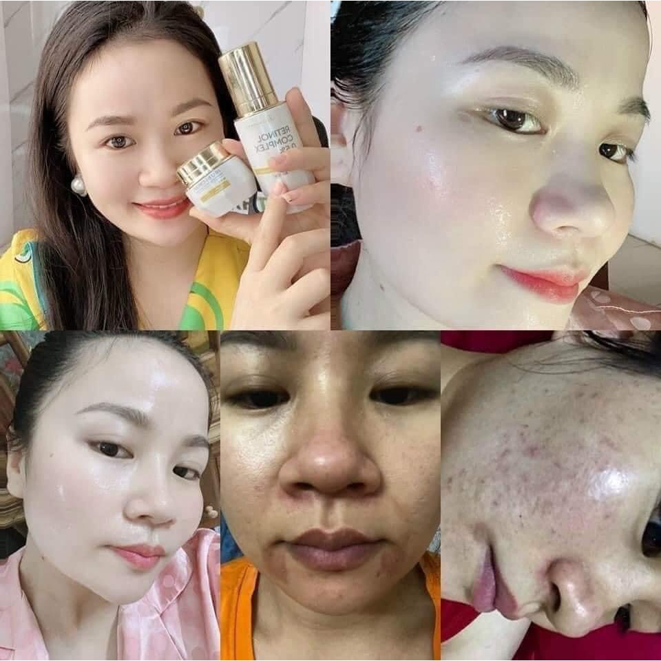 Kem dưỡng da ban đêm HeLi B5 30g phục hồi da tổn thương
