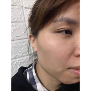 THAY DA MẶT TCA USA
