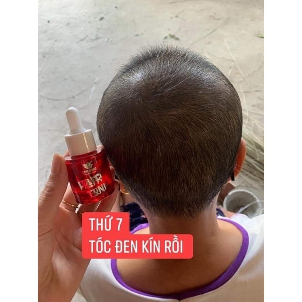 SẢN PHẨM HAIR TONIC