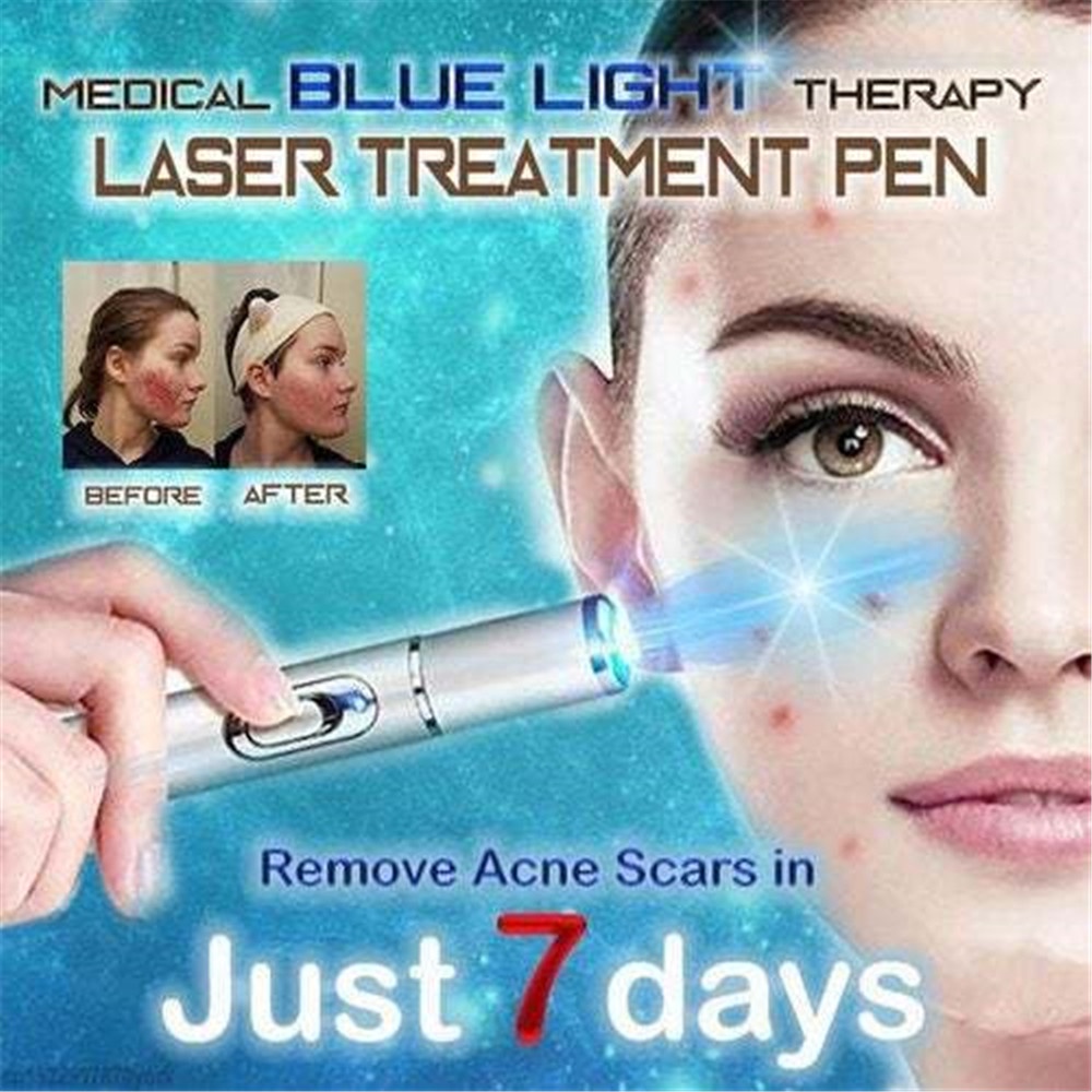 Bút Xóa Sẹo Bằng Tia Laser Ánh Sáng Xanh Mềm Mại Giúp Thư Giãn KD-7910